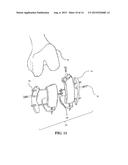 SYSTEM AND METHOD FOR REGISTRATION IN ORTHOPAEDIC APPLICATIONS diagram and image