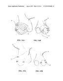 SYSTEM AND METHOD FOR REGISTRATION IN ORTHOPAEDIC APPLICATIONS diagram and image