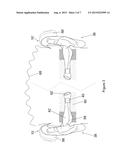 APPARATUS FOR DETERMINING COCHLEAR DEAD REGION diagram and image