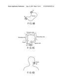 INSERTION SYSTEM, INSERTION SUPPORTING DEVICE, INSERTION SUPPORTING METHOD     AND RECORDING MEDIUM diagram and image