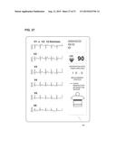 GARMENT FOR BIOINFORMATION MEASUREMENT HAVING ELECTRODE, BIOINFORMATION     MEASUREMENT SYSTEM AND BIOINFORMATION MEASUREMENT DEVICE, AND DEVICE     CONTROL METHOD diagram and image