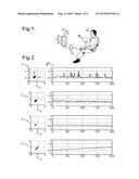 Screening Procedure for Identifying Risk of Arrhythmia diagram and image