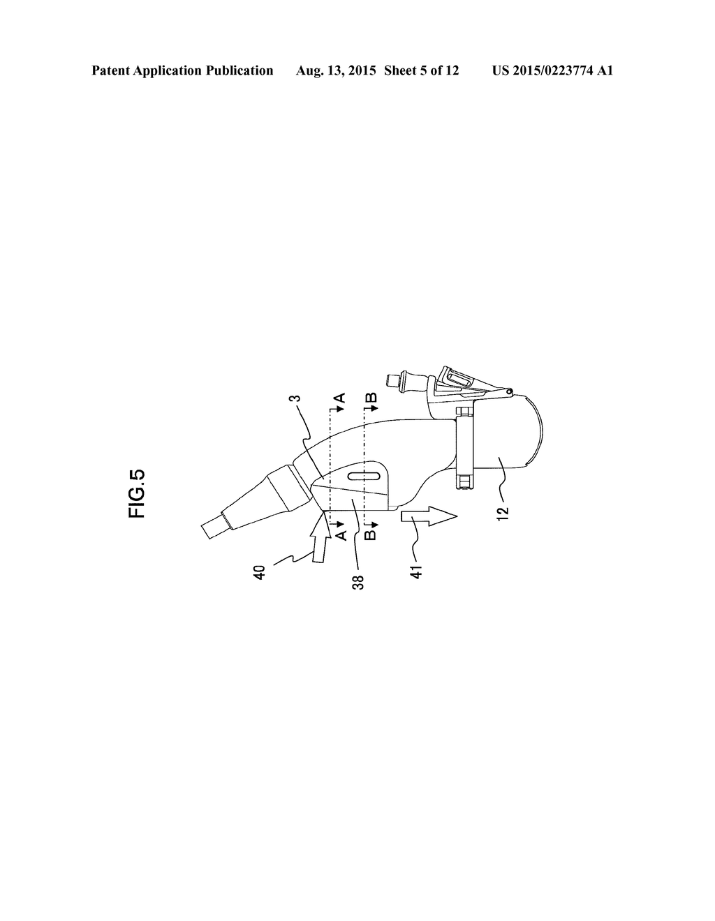 ULTRASONIC PROBE AND ULTRASONIC DIAGNOSTIC APPARATUS EMPLOYING THE SAME - diagram, schematic, and image 06