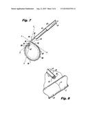 SUPER ELASTIC LOOP EXTRALUMINAL MATERIALS DELIVERY INSTRUMENT diagram and image