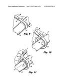 SUPER ELASTIC LOOP EXTRALUMINAL MATERIALS DELIVERY INSTRUMENT diagram and image