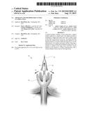 APPARATUS AND METHODS FOR CUTTING AN ATRIAL WALL diagram and image