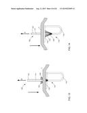 APPARATUS AND METHODS FOR CUTTING AN ATRIAL WALL diagram and image