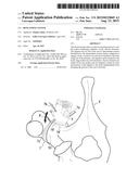 BONE FIXING SYSTEM diagram and image