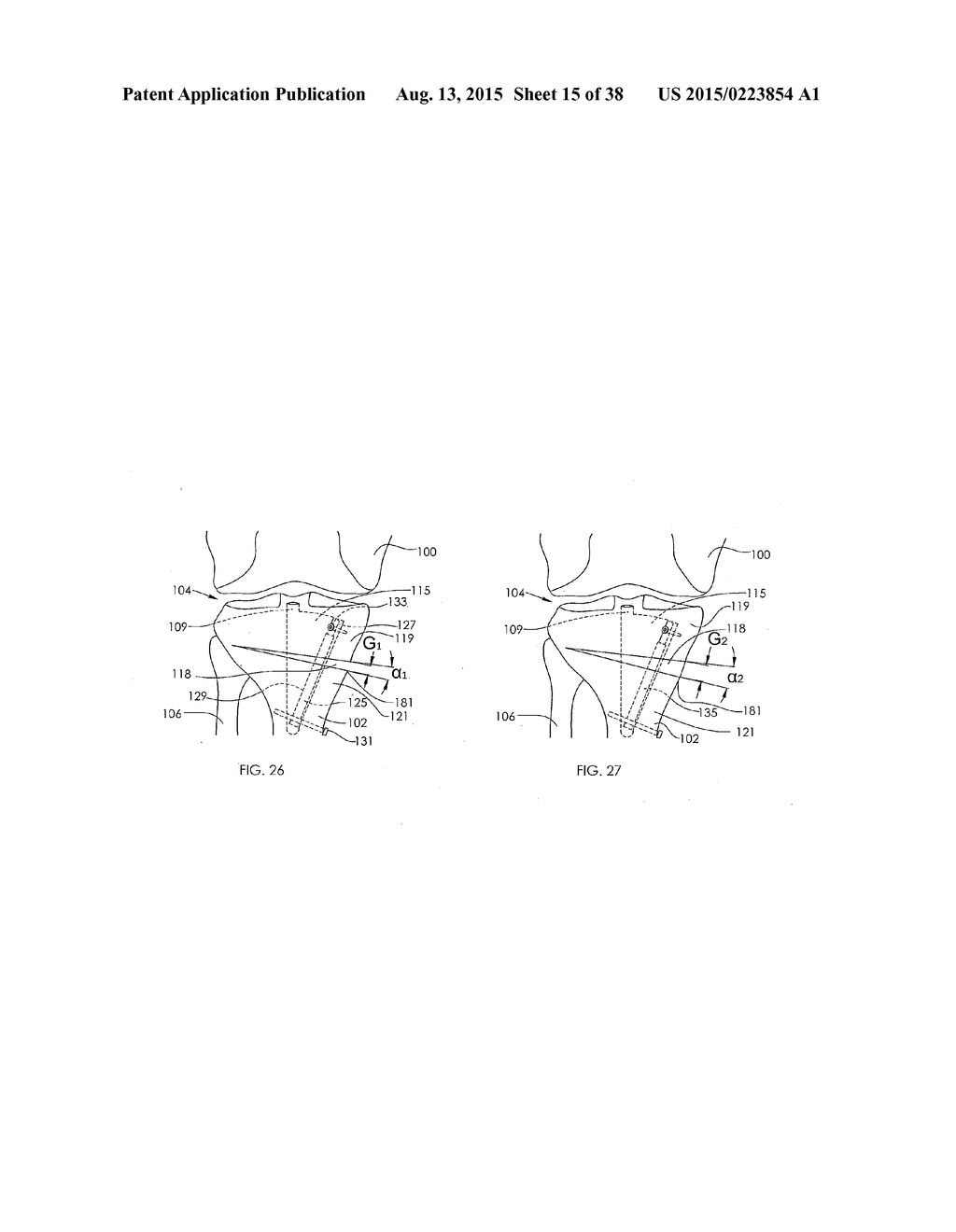 ADJUSTABLE DEVICES FOR TREATING ARTHRITIS OF THE KNEE - diagram, schematic, and image 16