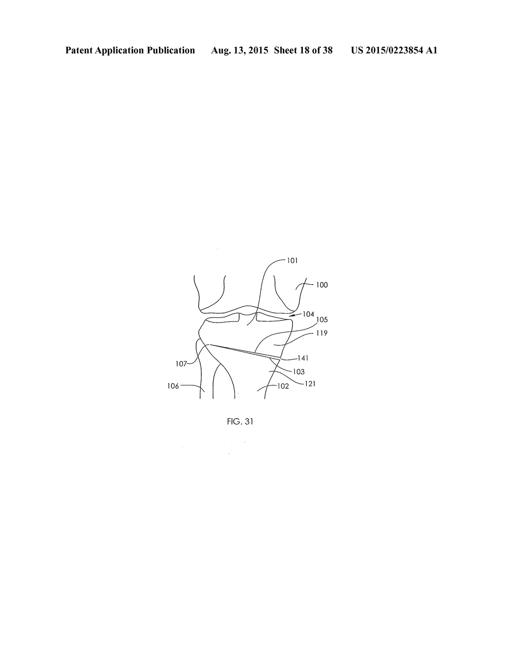 ADJUSTABLE DEVICES FOR TREATING ARTHRITIS OF THE KNEE - diagram, schematic, and image 19