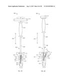 ADJUSTABLE DEVICES FOR TREATING ARTHRITIS OF THE KNEE diagram and image