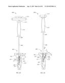 ADJUSTABLE DEVICES FOR TREATING ARTHRITIS OF THE KNEE diagram and image