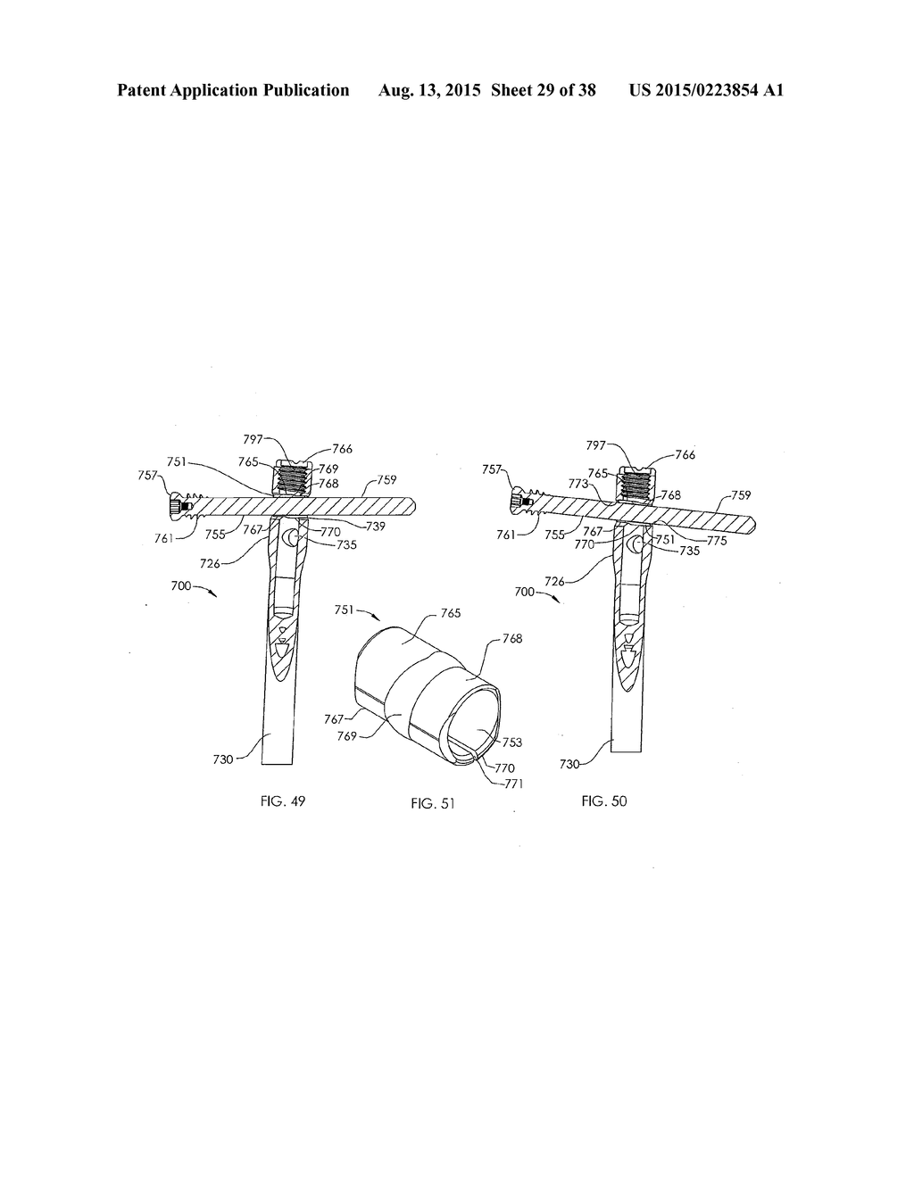 ADJUSTABLE DEVICES FOR TREATING ARTHRITIS OF THE KNEE - diagram, schematic, and image 30