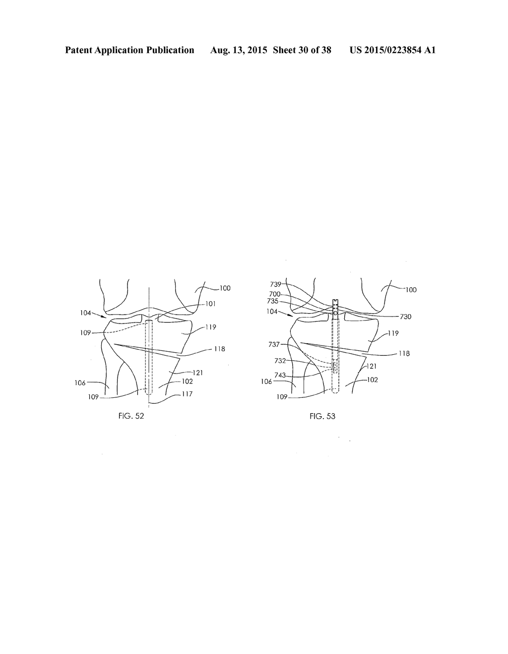 ADJUSTABLE DEVICES FOR TREATING ARTHRITIS OF THE KNEE - diagram, schematic, and image 31