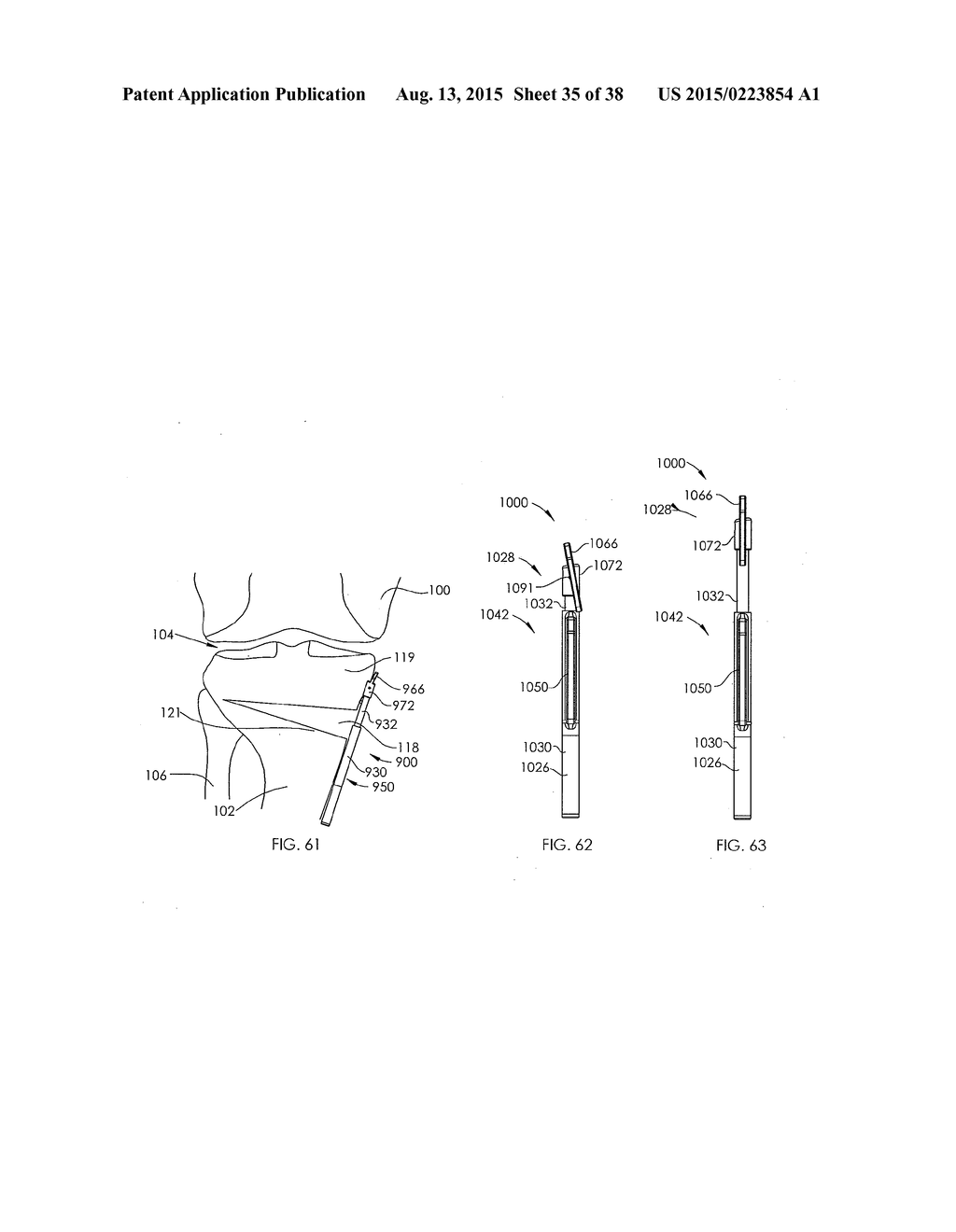 ADJUSTABLE DEVICES FOR TREATING ARTHRITIS OF THE KNEE - diagram, schematic, and image 36