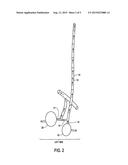 METHOD FOR THE TREATMENT OF BENIGN PROSTATIC HYPERPLASIA diagram and image