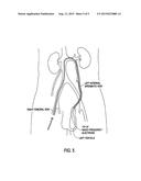 METHOD FOR THE TREATMENT OF BENIGN PROSTATIC HYPERPLASIA diagram and image