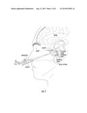 METHOD AND SYSTEM FOR TRANSCRANIAL PHOTOACOUSTIC IMAGING FOR GUIDING SKULL     BASE SURGERIES diagram and image