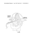 METHOD AND SYSTEM FOR TRANSCRANIAL PHOTOACOUSTIC IMAGING FOR GUIDING SKULL     BASE SURGERIES diagram and image