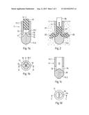 MEDICAL DEVICE, APPARATUS, AND SURGICAL METHOD diagram and image