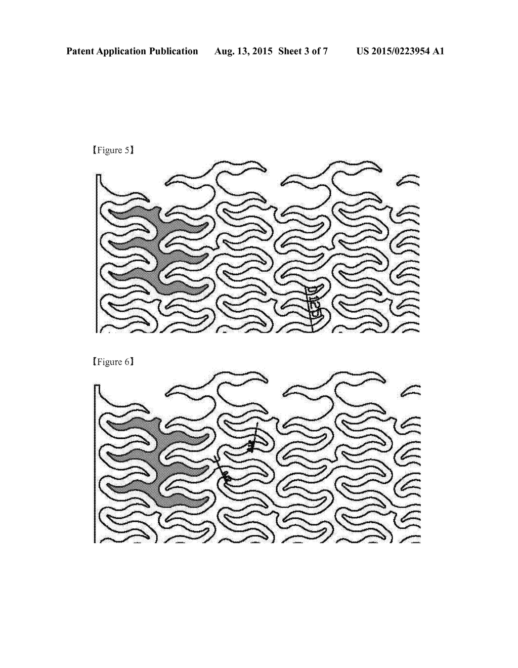 WIRE STENT - diagram, schematic, and image 04