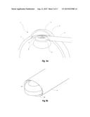 Ophthalmic Surgical Device for Capsulotomy diagram and image