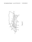 Internal Shunt And Method For Treating Glaucoma diagram and image