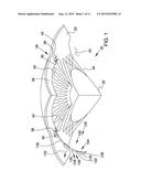 OCULAR IMPLANTS WITH ASYMMETRIC FLEXIBILITY diagram and image