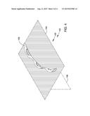 OCULAR IMPLANTS WITH ASYMMETRIC FLEXIBILITY diagram and image