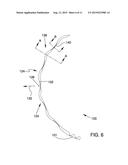 OCULAR IMPLANTS WITH ASYMMETRIC FLEXIBILITY diagram and image