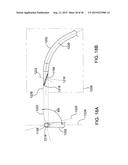 METHODS AND APPARATUS FOR DELIVERING OCULAR IMPLANTS  INTO THE EYE diagram and image