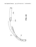 METHODS AND APPARATUS FOR DELIVERING OCULAR IMPLANTS  INTO THE EYE diagram and image