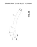 METHODS AND APPARATUS FOR DELIVERING OCULAR IMPLANTS  INTO THE EYE diagram and image