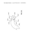 METHODS AND APPARATUS FOR DELIVERING OCULAR IMPLANTS  INTO THE EYE diagram and image