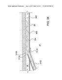 METHODS AND APPARATUS FOR DELIVERING OCULAR IMPLANTS  INTO THE EYE diagram and image