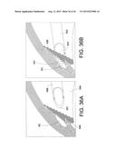 METHODS AND APPARATUS FOR DELIVERING OCULAR IMPLANTS  INTO THE EYE diagram and image