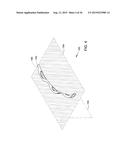 METHODS AND APPARATUS FOR DELIVERING OCULAR IMPLANTS  INTO THE EYE diagram and image