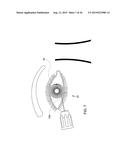 METHODS AND APPARATUS FOR DELIVERING OCULAR IMPLANTS  INTO THE EYE diagram and image