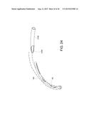 METHODS AND APPARATUS FOR DELIVERING OCULAR IMPLANTS  INTO THE EYE diagram and image