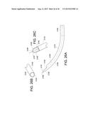 METHODS AND APPARATUS FOR DELIVERING OCULAR IMPLANTS  INTO THE EYE diagram and image