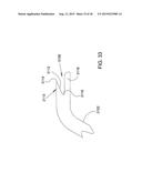 METHODS AND APPARATUS FOR DELIVERING OCULAR IMPLANTS  INTO THE EYE diagram and image