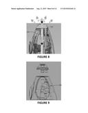 NASAL IRRIGATION ASSEMBLY AND SYSTEM diagram and image