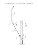 Central Venous Catheter Kit diagram and image