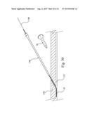 Central Venous Catheter Kit diagram and image