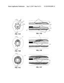 Treatment of Renal Hypertension or Carotid Sinus Syndrome with Adventitial     Pharmaceutical Sympathetic Denervation or Neuromodulation diagram and image