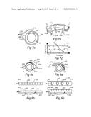 ENDOSCOPIC SYMPATHECTOMY SYSTEMS AND METHODS diagram and image