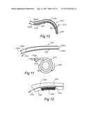 ENDOSCOPIC SYMPATHECTOMY SYSTEMS AND METHODS diagram and image