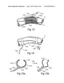 ENDOSCOPIC SYMPATHECTOMY SYSTEMS AND METHODS diagram and image