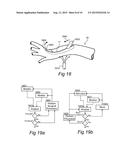 ENDOSCOPIC SYMPATHECTOMY SYSTEMS AND METHODS diagram and image