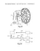 ENDOSCOPIC SYMPATHECTOMY SYSTEMS AND METHODS diagram and image